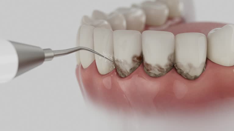 Trusted Wisdom Tooth Removal service in Dimmitt, TX - Dentist Open Now
